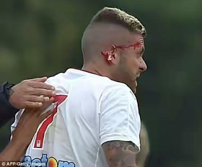 Footballer’s ear is partly ripped off after horror challenge in club friendly