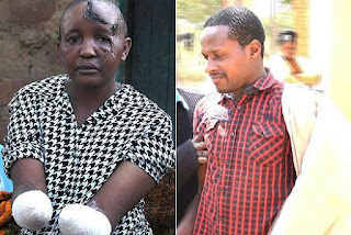 Photos/Video: Man chops off wife’s hands for not conceiving after seven years of marriage