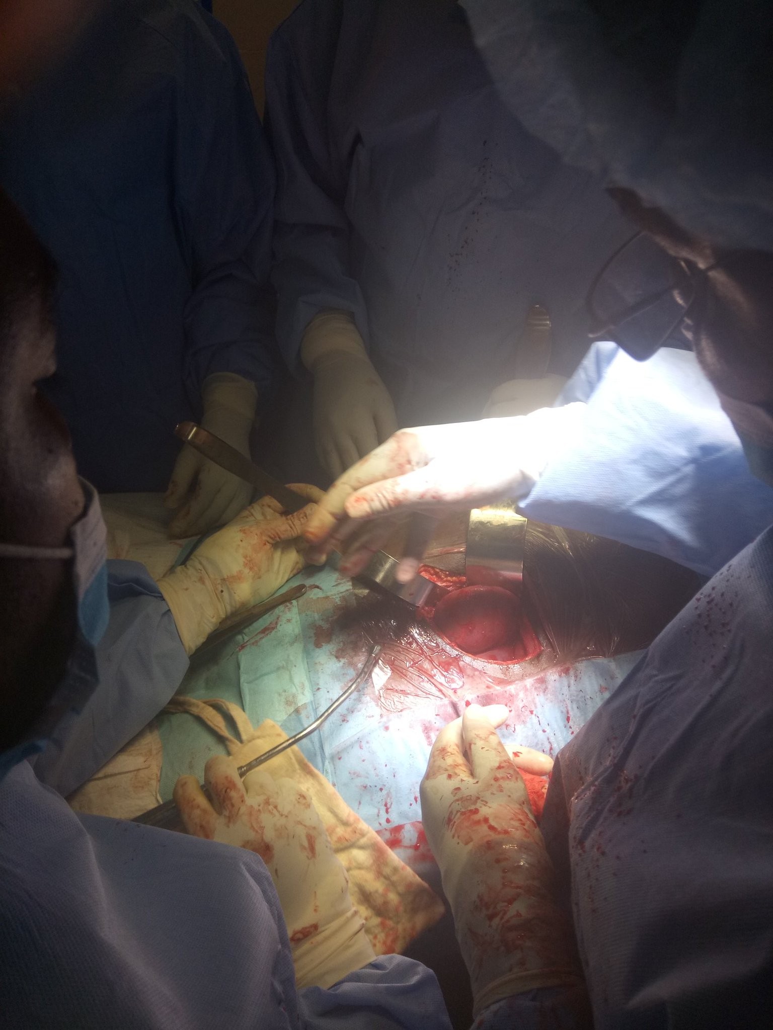  Photos: AKTH Kano carries out successful kidney transplant