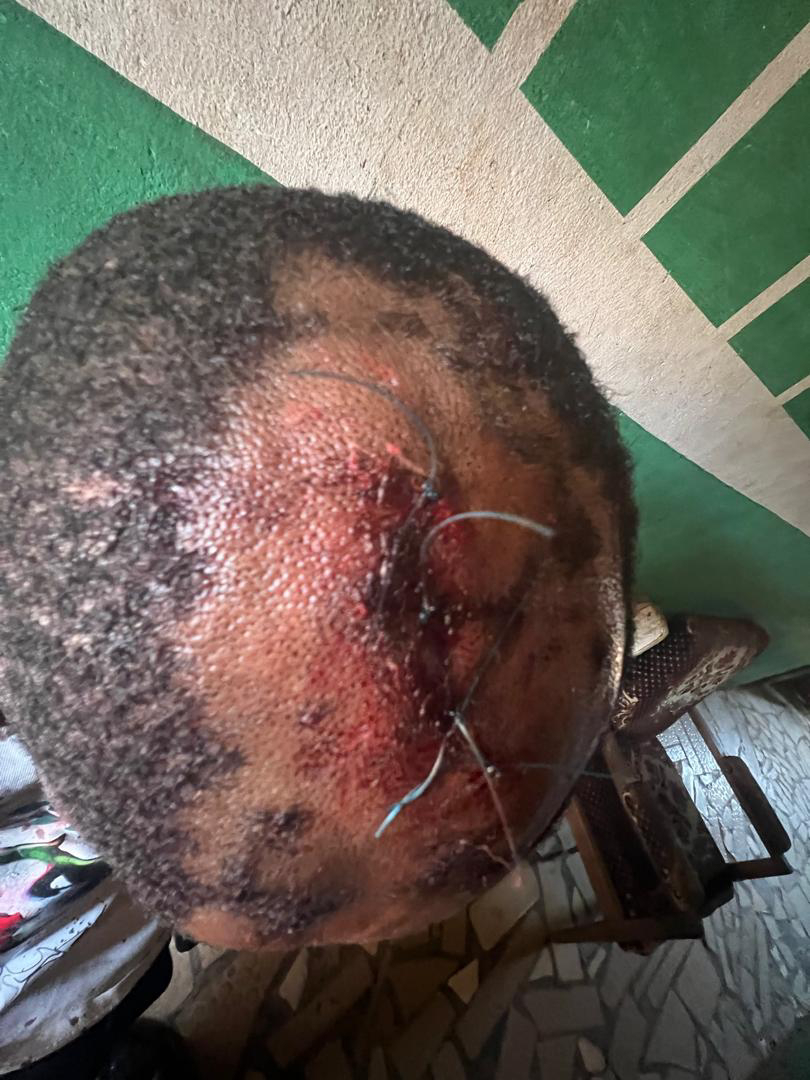 When Justice Becomes A Political Weapon In Ondo State